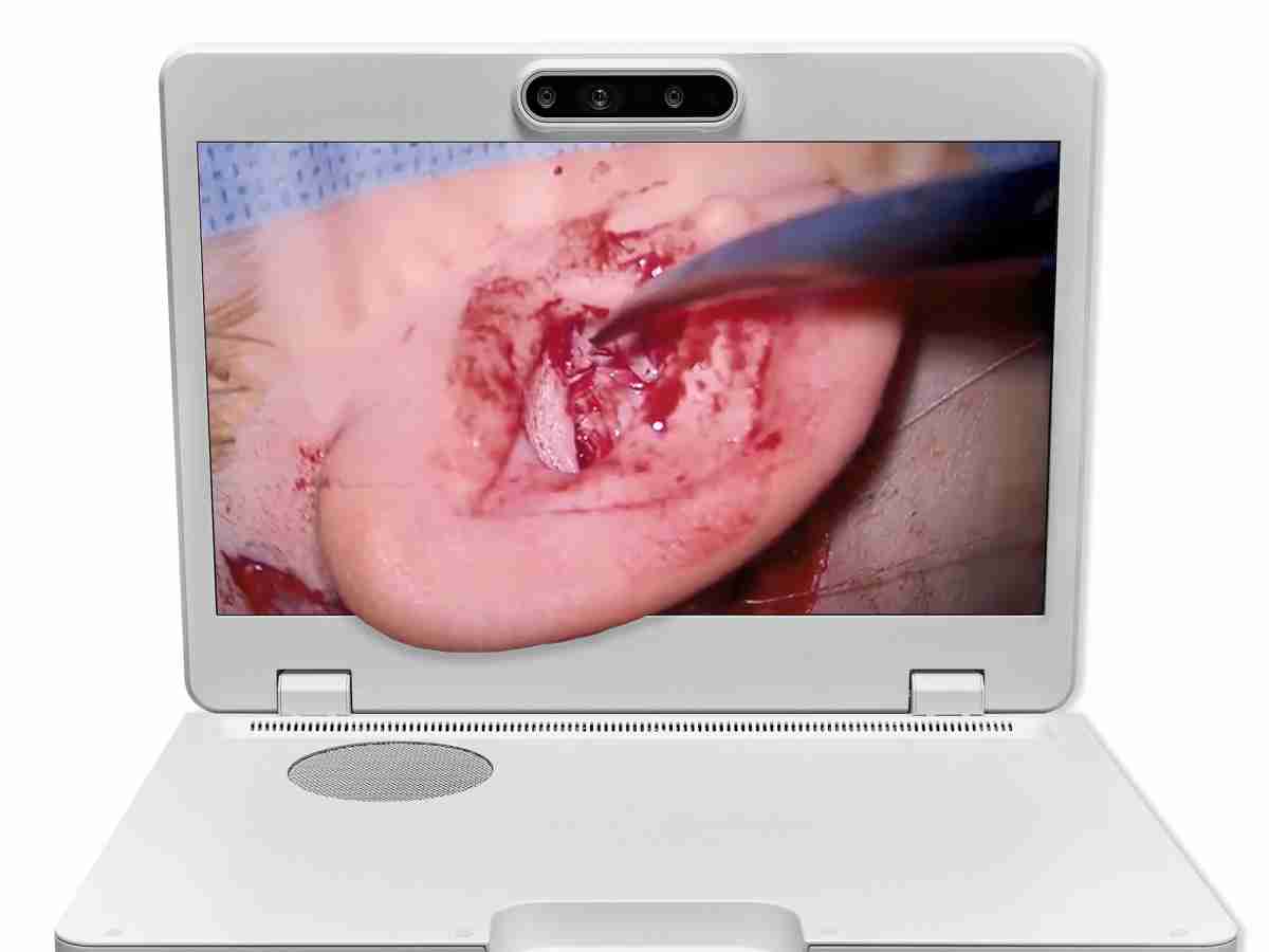 达擎之＂Heads-up 3D显微手术显示系统＂，，，，整合4K裸眼3D显示及眼球追踪系统，，具备快速追踪人眼移动位置功能，，，，减轻医师长时间维持固定姿势的负担，，让医师能有更宽广清晰的3D立体视野及更舒适的姿势来执行手术。。。